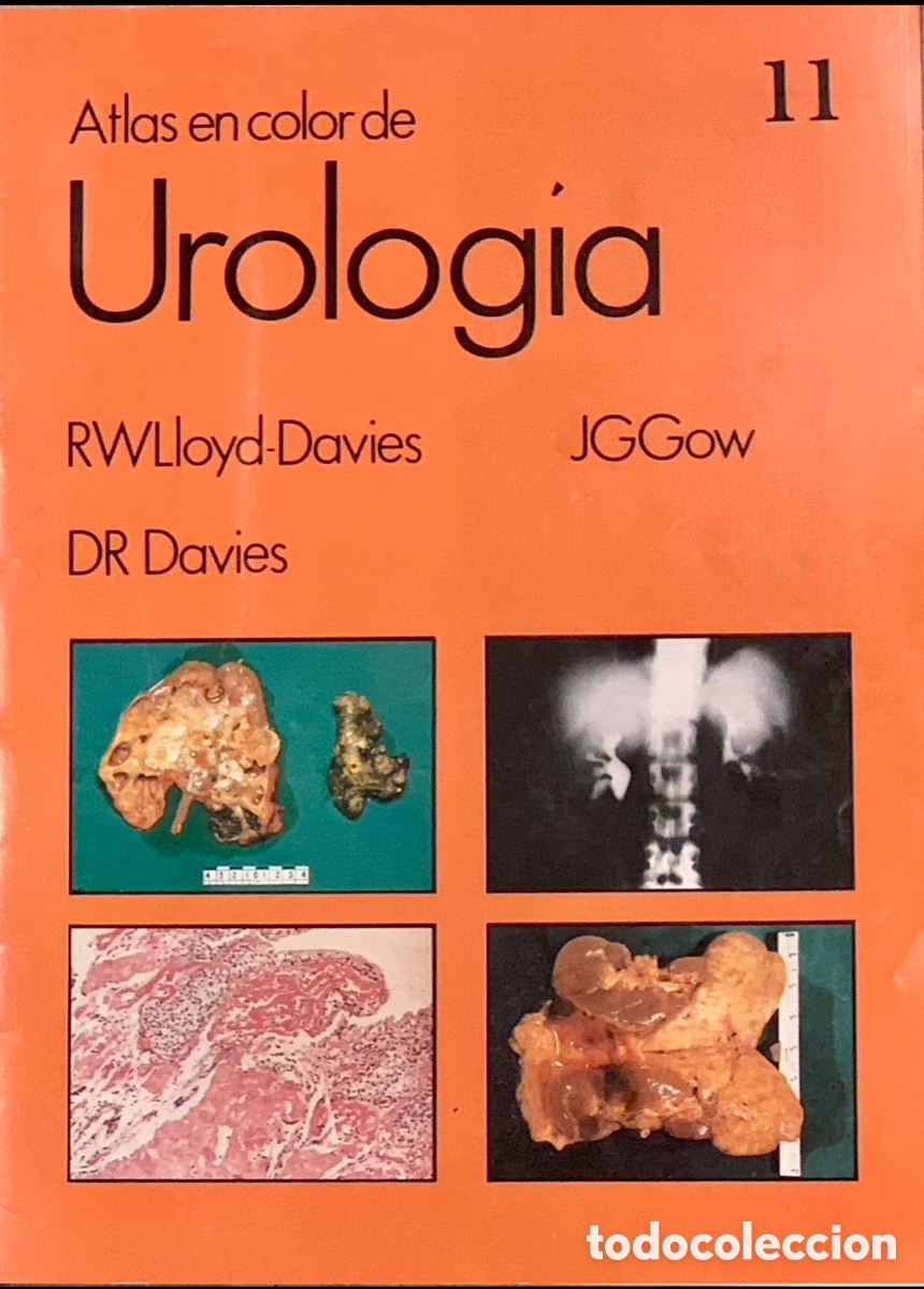 Coleccionismo de revistas y peri&oacute;dicos: Revista. Atlas en color de Urolog&iacute;a, 11. 1983.