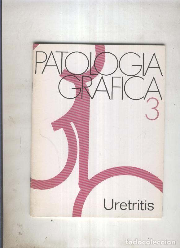 Coleccionismo de Revistas y Peri&oacute;dicos: Patologia grafica numero 03: Uretritis - Varios