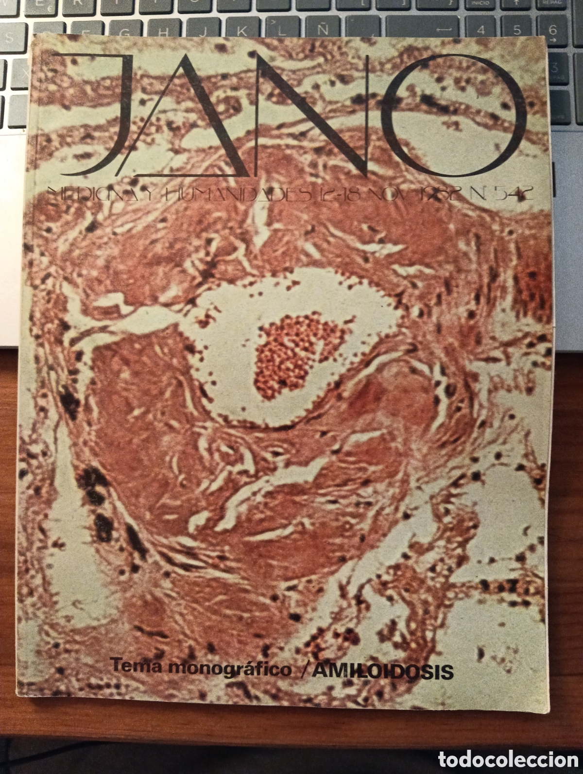 Coleccionismo de revistas y peri&oacute;dicos: Revista Jano, 542, Tema Monogr&aacute;fico, amiloidosis