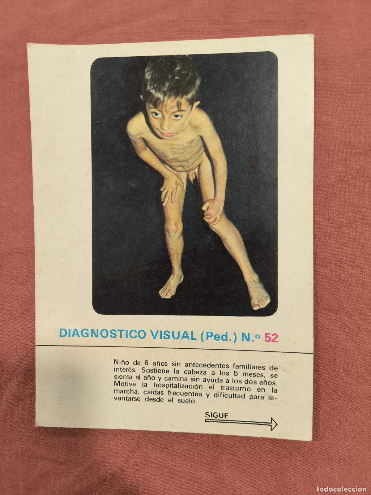 Sammeln von Zeitschriften und Zeitungen: L&aacute;mina Diagn&oacute;stico Visual Pediatr&iacute;a N&ordm; 52 Almirall &ndash; Caso Cl&iacute;nico Coleccionable