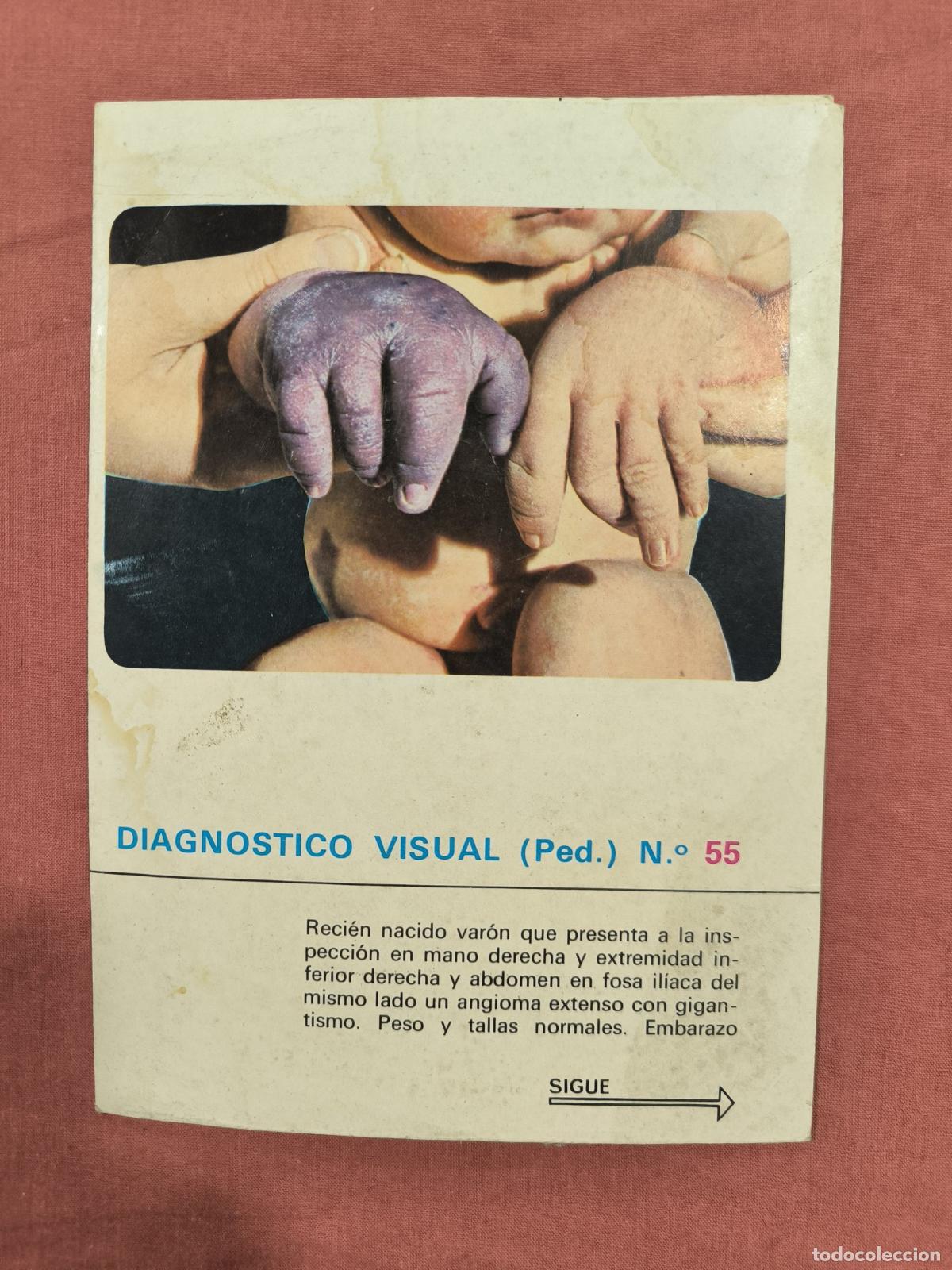 Sammeln von Zeitschriften und Zeitungen: L&aacute;mina Diagn&oacute;stico Visual Pediatr&iacute;a N&ordm; 55 Almirall &ndash; Caso Cl&iacute;nico Coleccionable