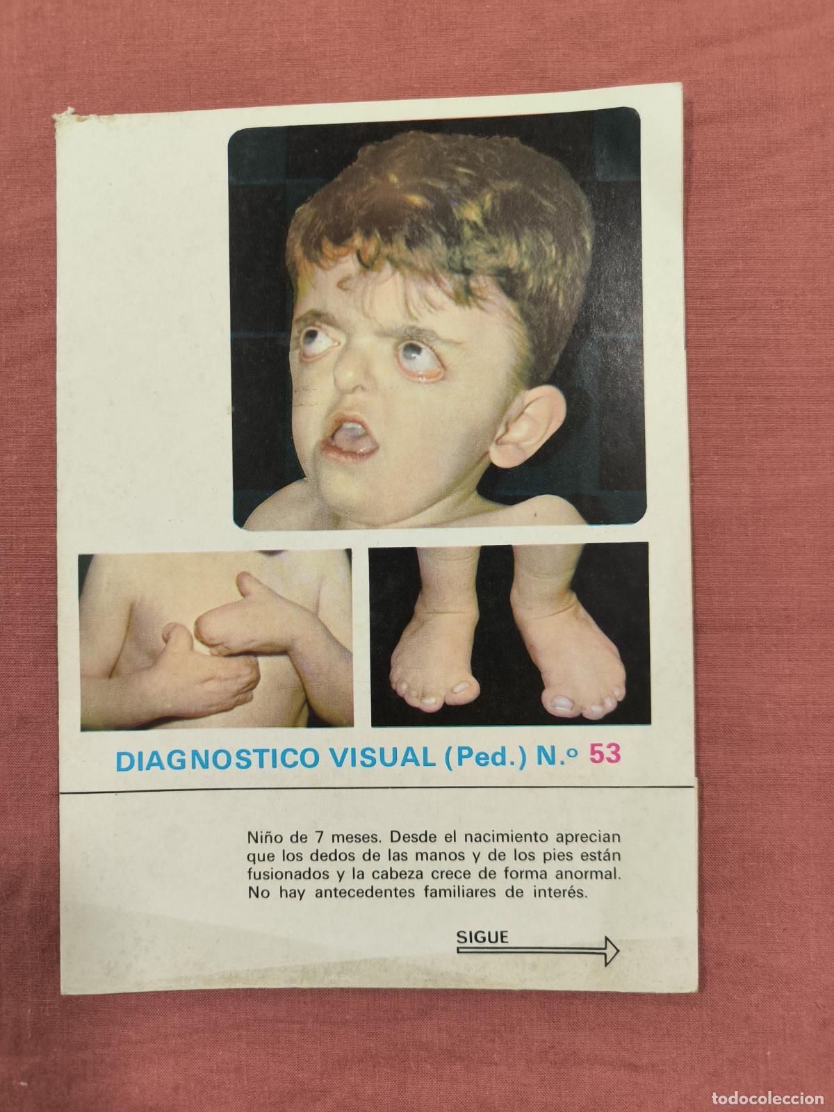 Sammeln von Zeitschriften und Zeitungen: L&aacute;mina Diagn&oacute;stico Visual Pediatr&iacute;a N&ordm; 53 Almirall &ndash; Caso Cl&iacute;nico Coleccionable