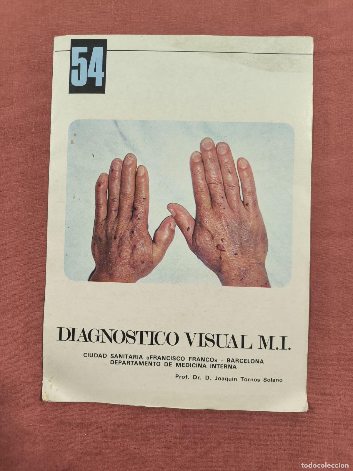 Sammeln von Zeitschriften und Zeitungen: L&aacute;mina Diagn&oacute;stico Visual Medicina Interna N&ordm; 54 Almirall &ndash; Caso Cl&iacute;nico