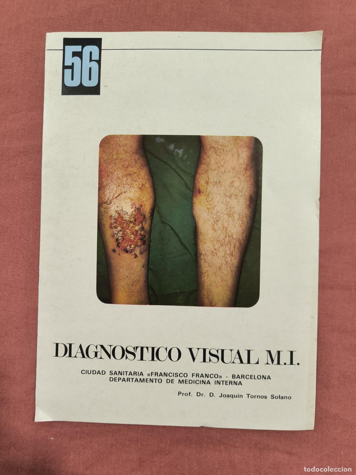 Sammeln von Zeitschriften und Zeitungen: L&aacute;mina Diagn&oacute;stico Visual Medicina Interna N&ordm; 56 Almirall &ndash; Caso Cl&iacute;nico