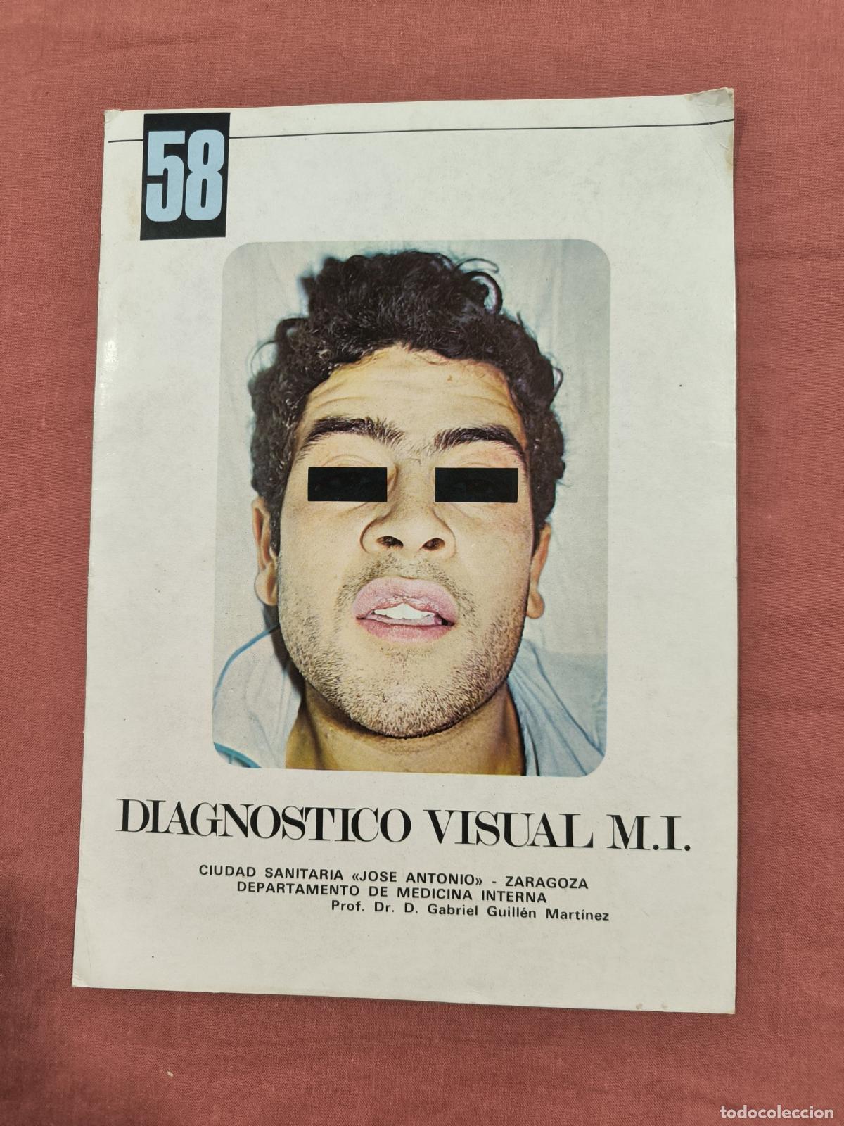 Sammeln von Zeitschriften und Zeitungen: L&aacute;mina Diagn&oacute;stico Visual Medicina Interna N&ordm; 58 Almirall &ndash; Caso Cl&iacute;nico