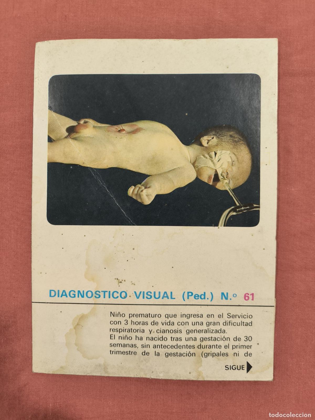 Sammeln von Zeitschriften und Zeitungen: L&aacute;mina Diagn&oacute;stico Visual Pediatr&iacute;a N&ordm; 61 Almirall &ndash; Caso Cl&iacute;nico Coleccionable