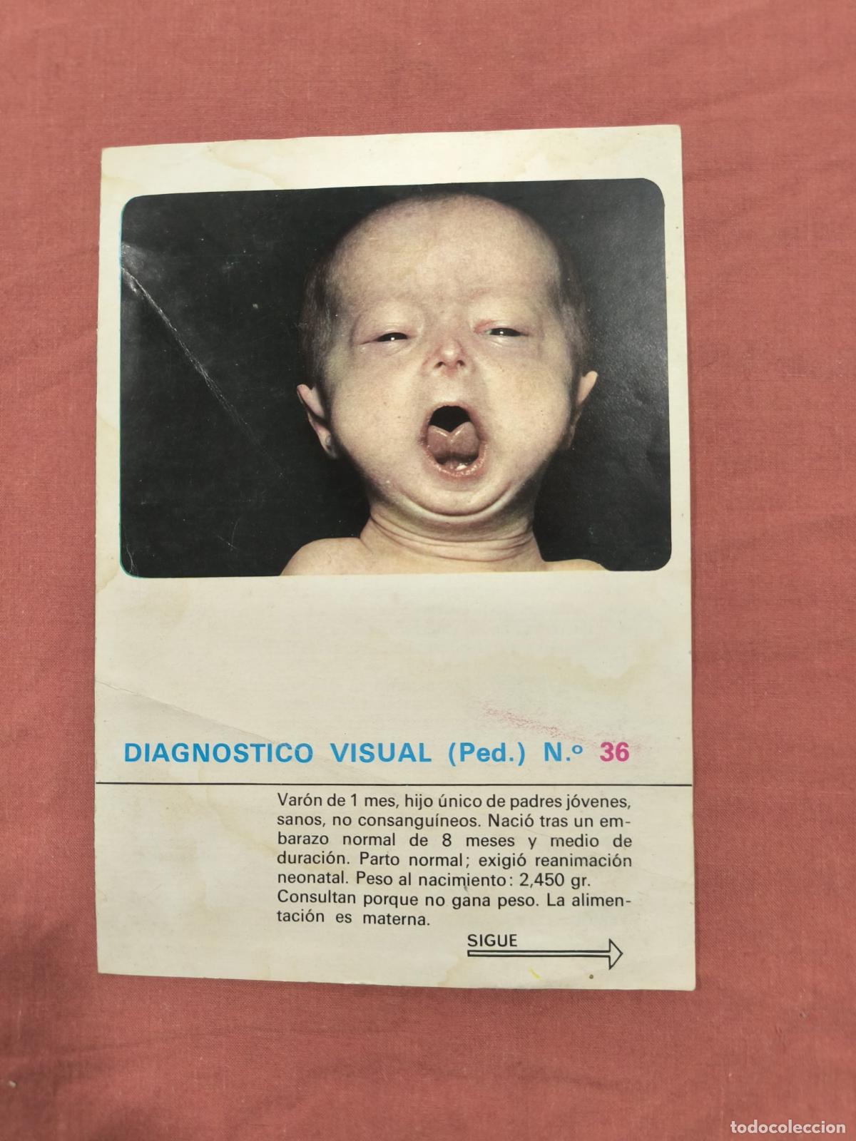 Sammeln von Zeitschriften und Zeitungen: L&aacute;mina Diagn&oacute;stico Visual Pediatr&iacute;a N&ordm; 36 Almirall &ndash; Caso Cl&iacute;nico Coleccionable
