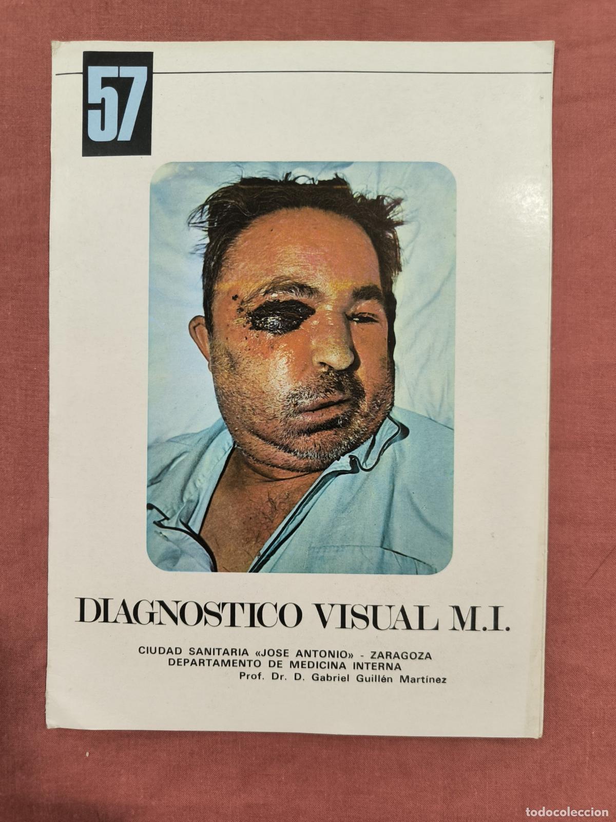Sammeln von Zeitschriften und Zeitungen: L&aacute;mina Diagn&oacute;stico Visual Medicina Interna N&ordm; 57 Almirall &ndash; Caso Cl&iacute;nico