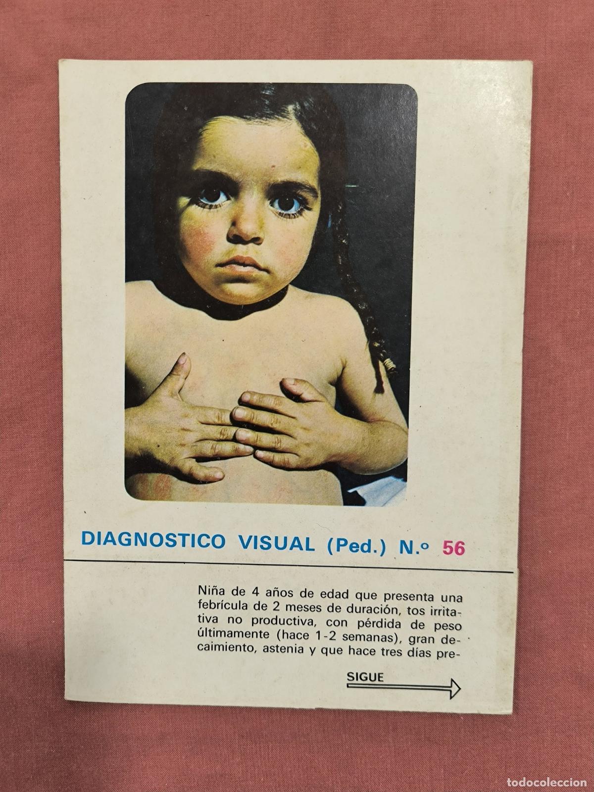 Collectionnisme de Revues et Journaux: L&aacute;mina Diagn&oacute;stico Visual Pediatr&iacute;a N&ordm; 56 Almirall &ndash; Caso Cl&iacute;nico Medicina