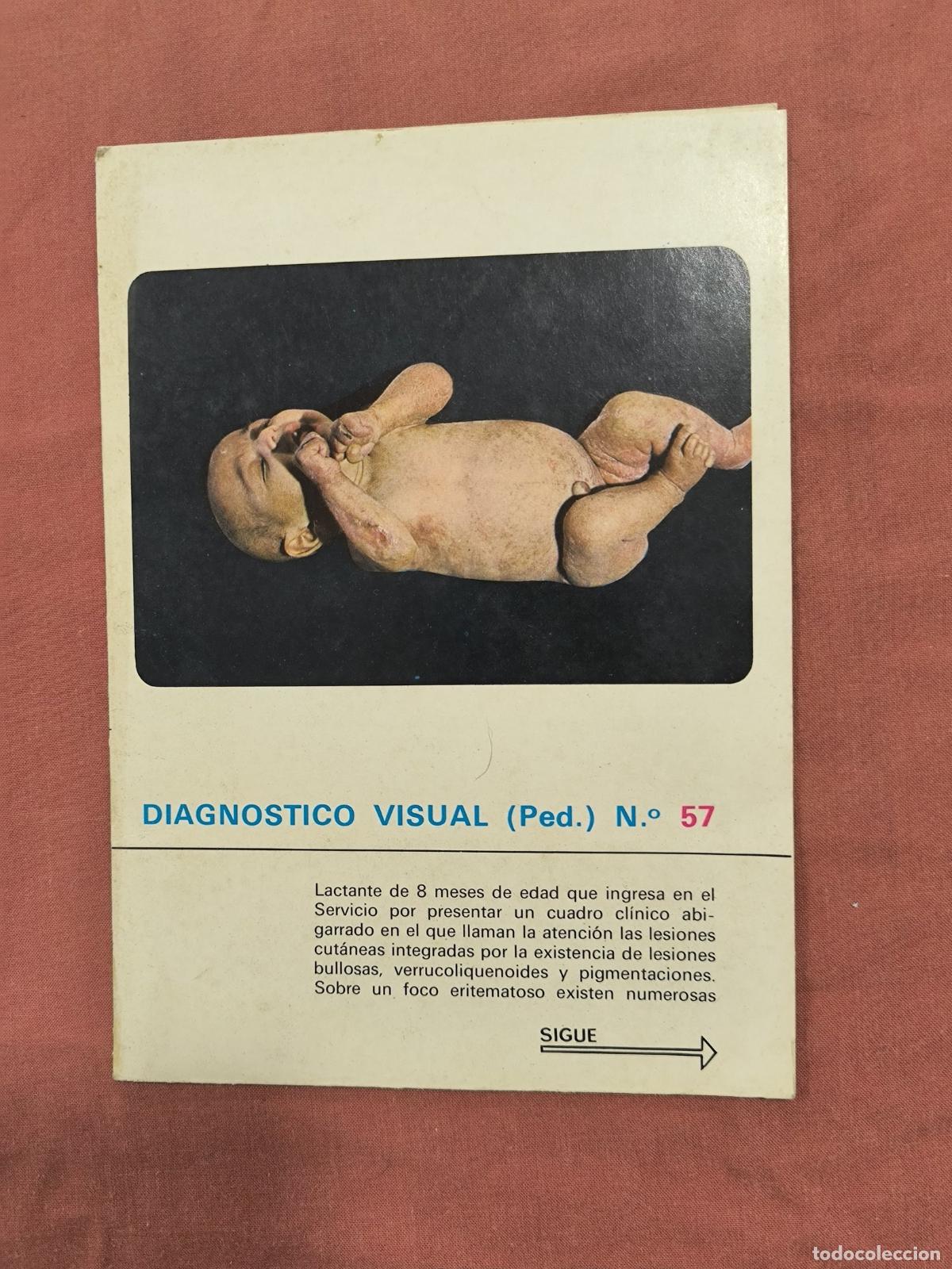 Collectionnisme de Revues et Journaux: L&aacute;mina Diagn&oacute;stico Visual Pediatr&iacute;a N&ordm; 57 Almirall &ndash; Caso Cl&iacute;nico Medicina