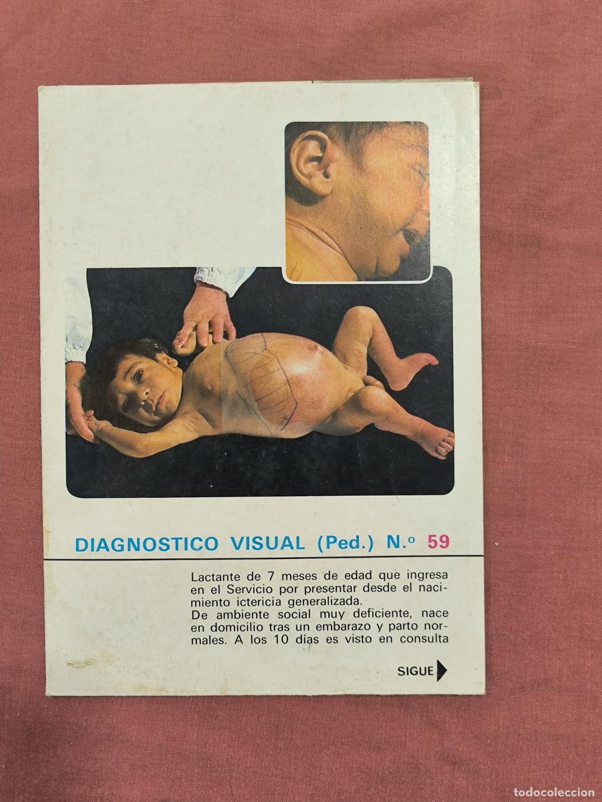 Collectionnisme de Revues et Journaux: L&aacute;mina Diagn&oacute;stico Visual Pediatr&iacute;a N&ordm; 59 Almirall &ndash; Caso Cl&iacute;nico Medicina