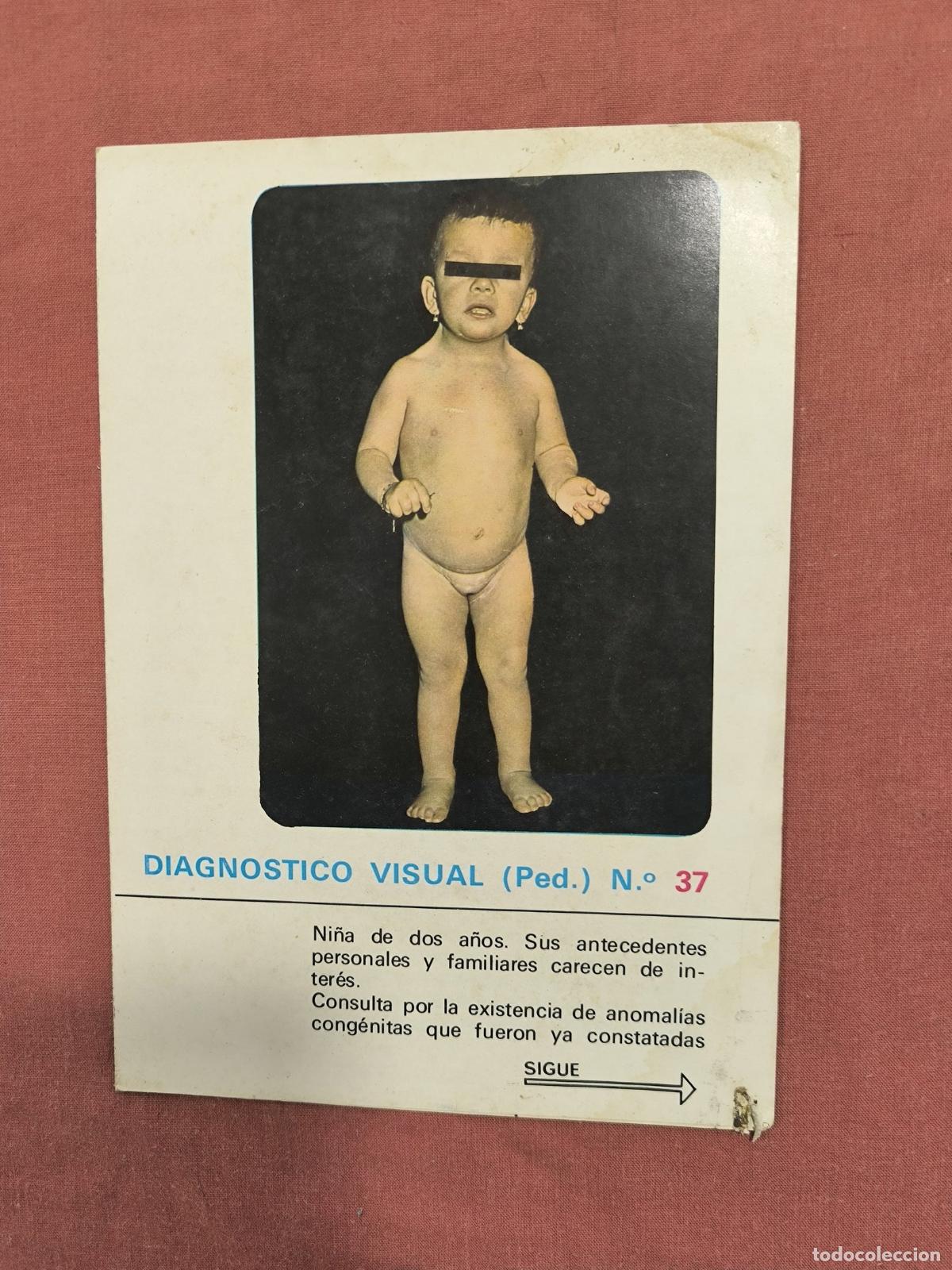 Collectionnisme de Revues et Journaux: L&aacute;mina Diagn&oacute;stico Visual Pediatr&iacute;a N&ordm; 37 Almirall &ndash; Caso Cl&iacute;nico Medicina