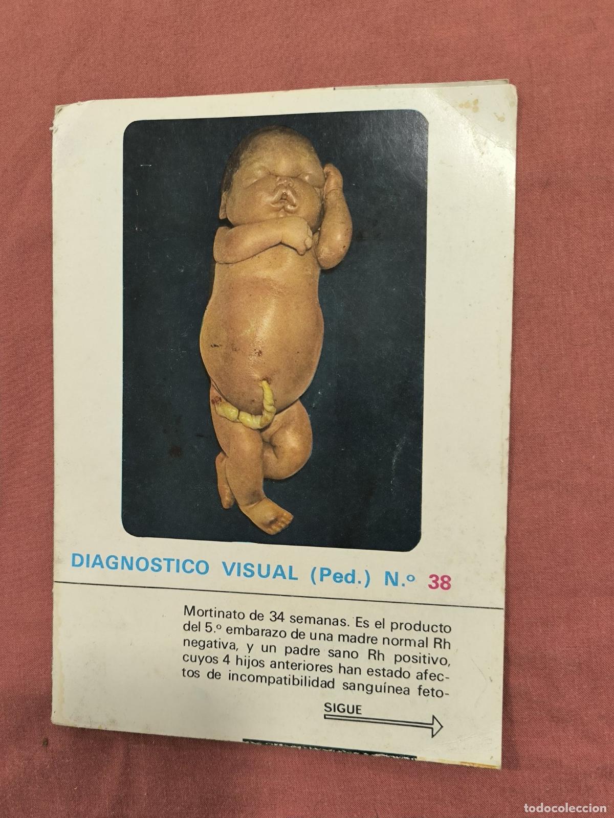 Collection Magazines and Newspapers: L&aacute;mina Diagn&oacute;stico Visual Pediatr&iacute;a N&ordm; 38 Almirall &ndash; Caso Cl&iacute;nico Medicina