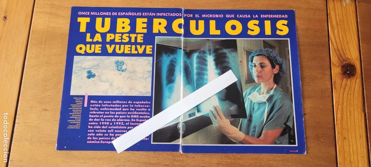 Coleccionismo de revistas y peri&oacute;dicos: RETAL 1993: ESPA&Ntilde;A, LA VUELTA DE LA TUBERCULOSIS