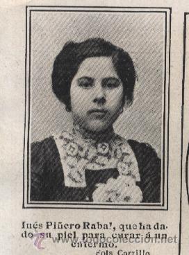 Collectionnisme: * &Aacute;GUILAS * DERMATOLOG&Iacute;A * In&eacute;s Pi&ntilde;ero y Manuela Ram&iacute;rez, donantes de piel - 1910