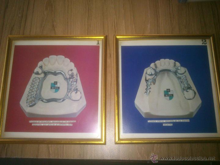 Coleccionismo: protesis dental - Foto 1