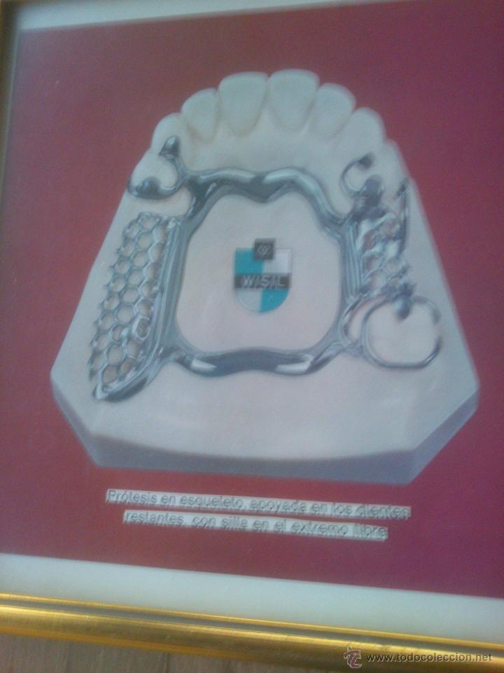 Coleccionismo: protesis dental - Foto 2