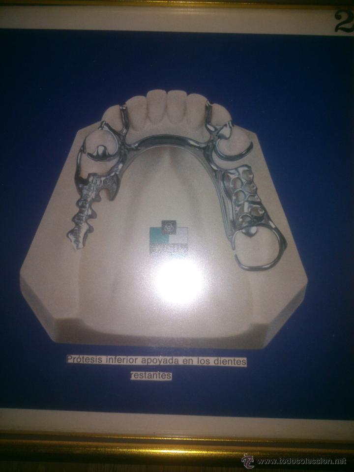 Coleccionismo: protesis dental - Foto 3