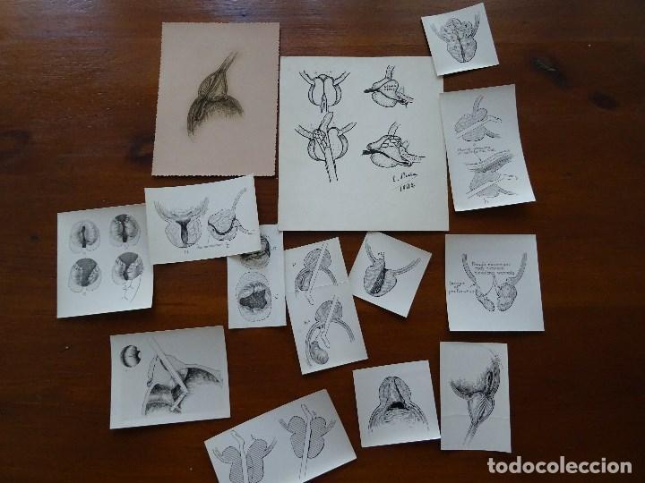 Coleccionismo: Medicina, l&aacute;minas m&eacute;dicas - Foto 1