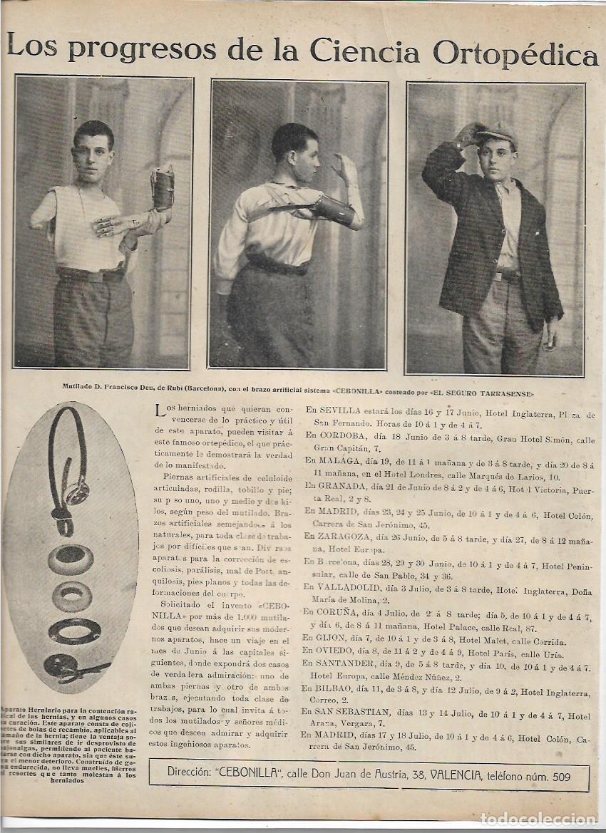 Colecionismo: 1925 PROGRESOS ORTOPEDIA FRANCISCO DEU RUBI BRAZO ARTIFICIAL SISTEMA CEBONILLA SEGURO TARRASENSE