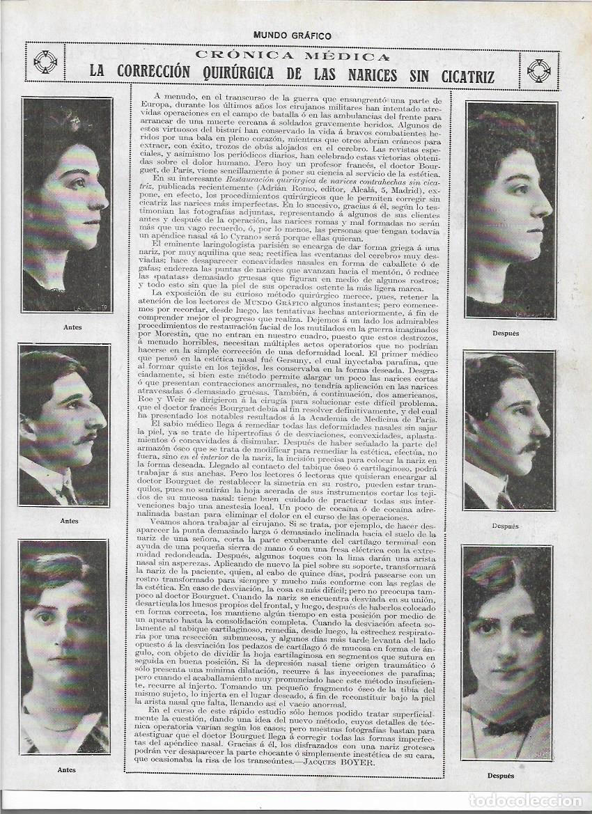 Collezionismo: A&Ntilde;O 1919 RECORTE PRENS MEDICINA CIRUGIA PLASTICA NARIZ CORRECCION QUIRURGICA SIN CICATRICES ESTETICA