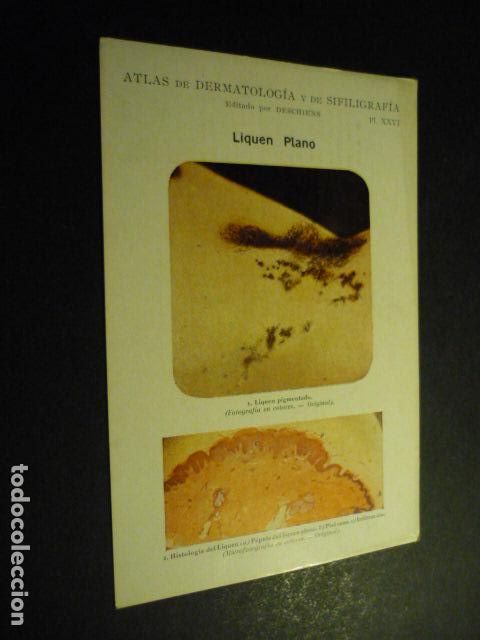 Collecting paper: TARJETA CROMOLITOGRAFICA ENFERMEDADES DE LA PIEL DERMATOLOGIA HACIA 1915 10 X 15 CM