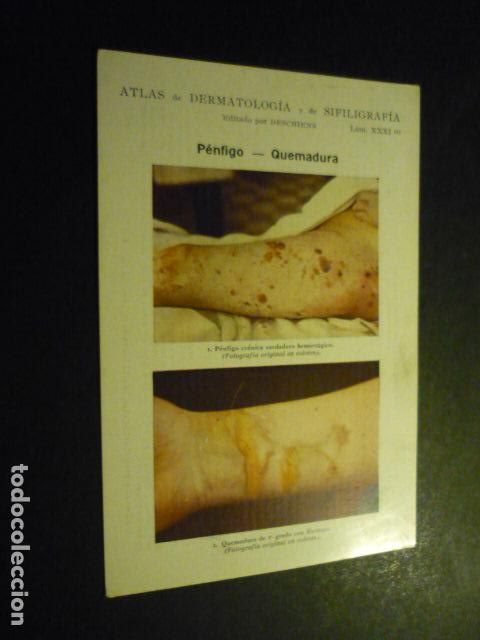 Sammelleidenschaft Papier: TARJETA CROMOLITOGRAFICA ENFERMEDADES DE LA PIEL DERMATOLOGIA HACIA 1915 10 X 15 CM