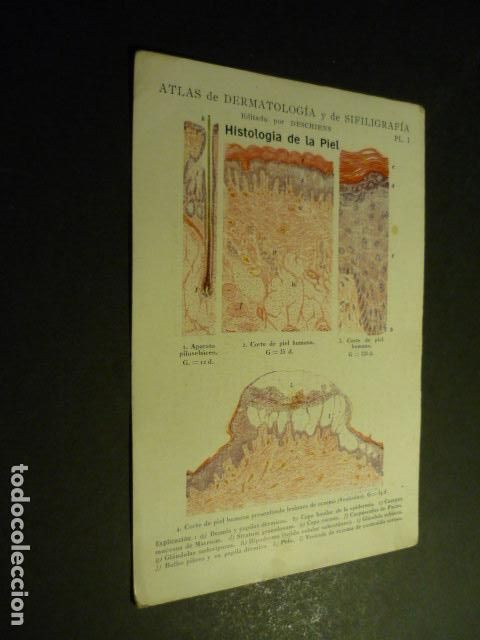 Sammelleidenschaft Papier: TARJETA CROMOLITOGRAFICA ENFERMEDADES DE LA PIEL DERMATOLOGIA HACIA 1915 10 X 15 CM