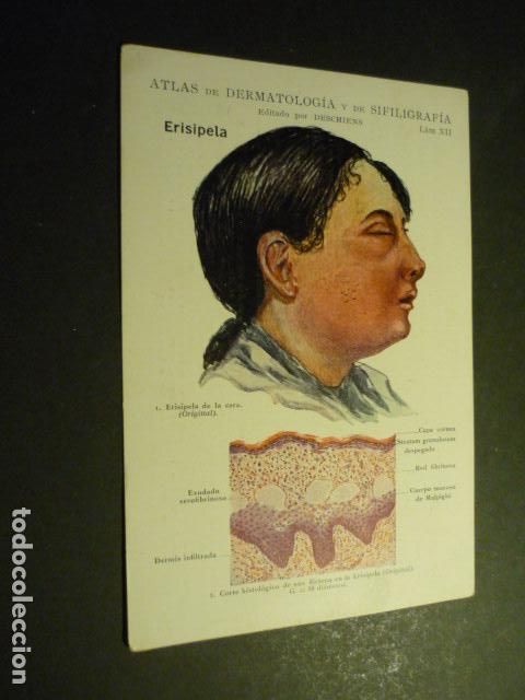 Collecting paper: TARJETA CROMOLITOGRAFICA ENFERMEDADES DE LA PIEL DERMATOLOGIA HACIA 1915 10 X 15 CM