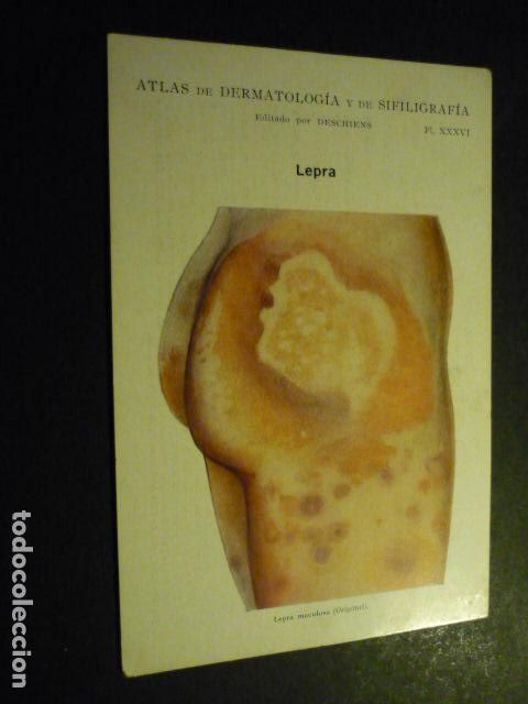 Sammelleidenschaft Papier: TARJETA CROMOLITOGRAFICA ENFERMEDADES DE LA PIEL DERMATOLOGIA HACIA 1915 10 X 15 CM