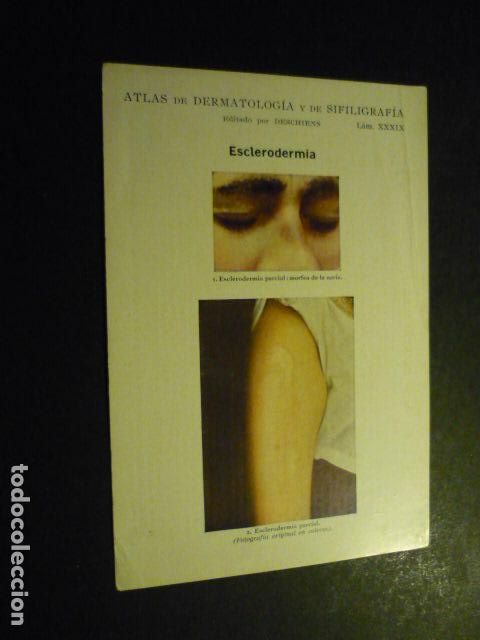 Sammelleidenschaft Papier: TARJETA CROMOLITOGRAFICA ENFERMEDADES DE LA PIEL DERMATOLOGIA HACIA 1915 10 X 15 CM