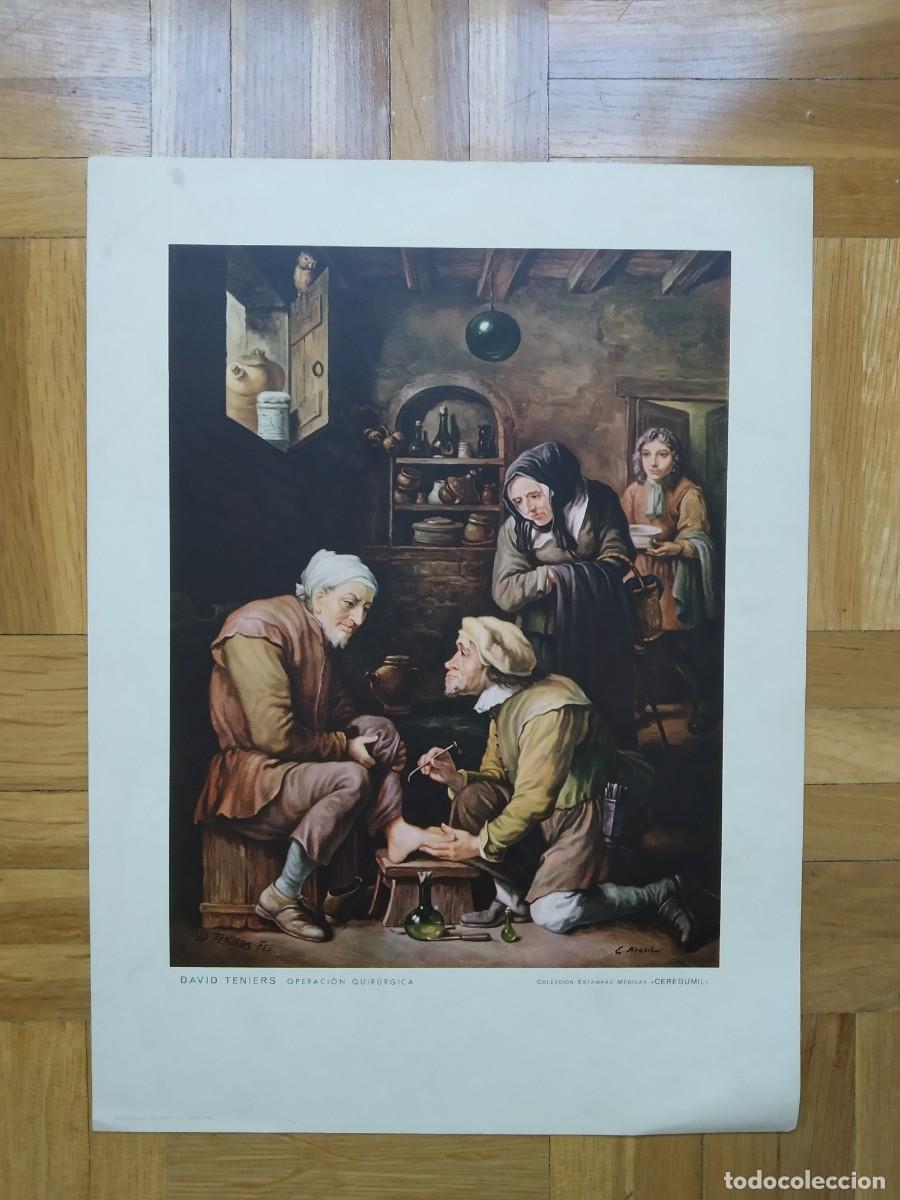 Coleccionismo: LAMINA DEL CUADRO OPERACION QUIRURGICA DAVID TENIERS COLECCION ESTAMPAS MEDICAS CERGUMIL 30 X 22 CM