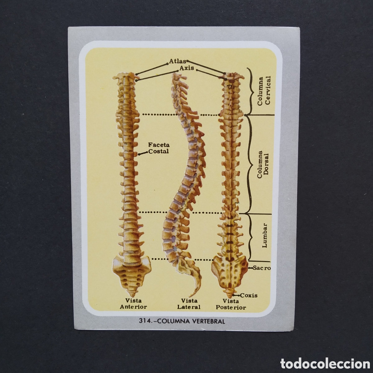Coleccionismo Cromos antiguos: CROMO - N&deg; 314 - COLUMNA VERTEBRAL - VIDA Y COLOR - ED. &Aacute;LBUMES ESPA&Ntilde;OLES S.A. - A&Ntilde;O 1965