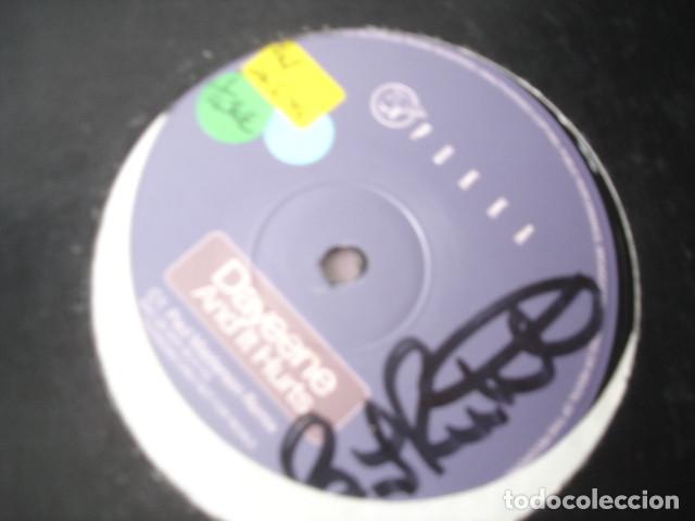 Discos de vinilo: DaYeene   And It Hurts - Foto 1