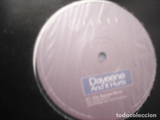 Discos de vinilo: DaYeene   And It Hurts - Foto 2