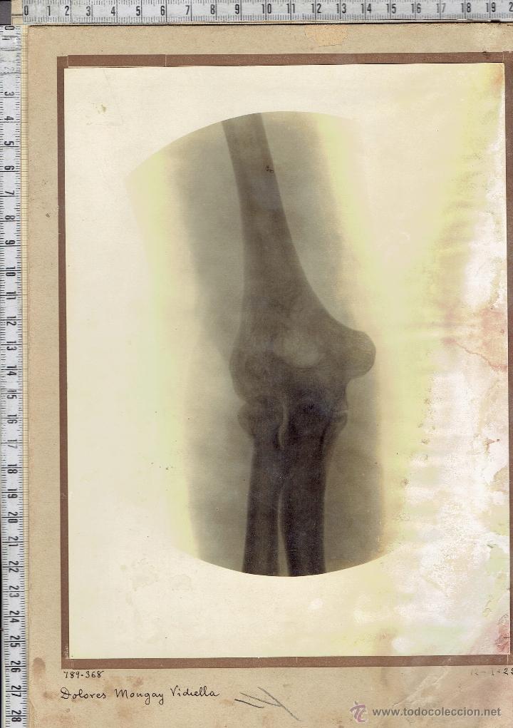 Antique Photography: RADIOGRAFIA FOTOGRAFICA 1922-EXTREMIDAD-CORPOREA.