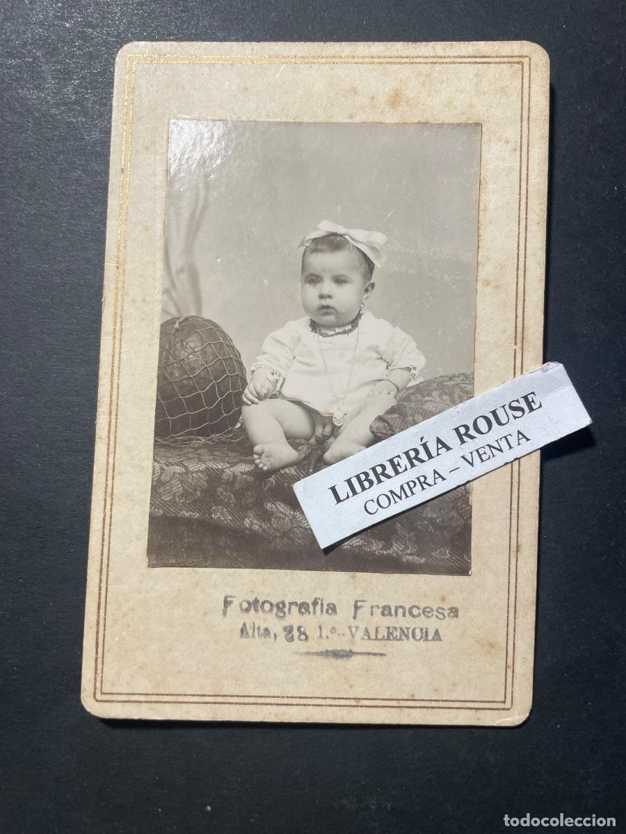 Fotograf&iacute;a antigua: VALENCIA - ANTIGUA FOTOGRAFIA NI&Ntilde;A CON DEFORMACION ORGANO SEXUAL- FOTOGRAFIA FRANCESA C. ALTA 28-1&ordm;