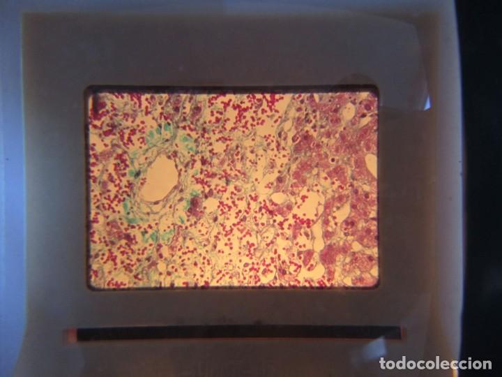 Fotografía antigua: 47 diapositivas microfotografías de tejidos biológicos, medicina - Foto 4 - 228456046