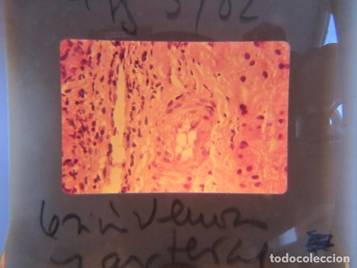 Fotografía antigua: 47 diapositivas microfotografías de tejidos biológicos, medicina - Foto 6 - 228456046
