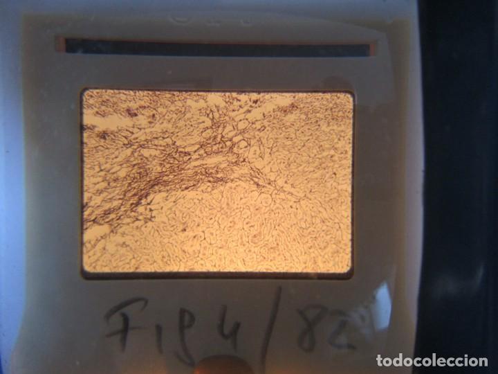 Fotografía antigua: 47 diapositivas microfotografías de tejidos biológicos, medicina - Foto 7 - 228456046