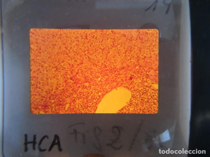 Fotografía antigua: 47 diapositivas microfotografías de tejidos biológicos, medicina - Foto 8 - 228456046