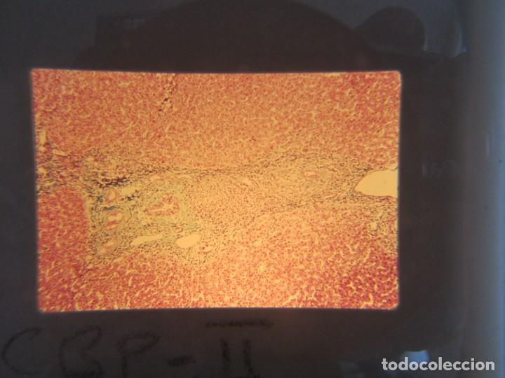 Fotografía antigua: 47 diapositivas microfotografías de tejidos biológicos, medicina - Foto 10 - 228456046
