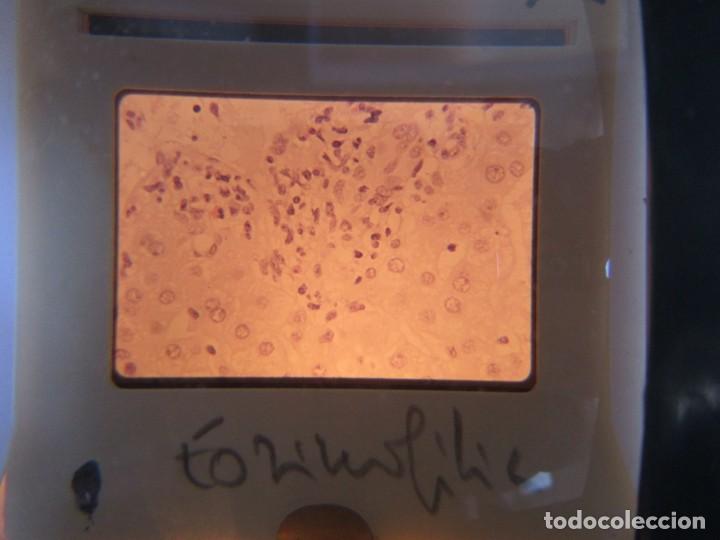 Fotografía antigua: 47 diapositivas microfotografías de tejidos biológicos, medicina - Foto 13 - 228456046