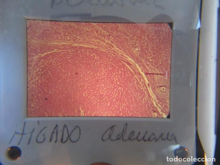 Fotografía antigua: 47 diapositivas microfotografías de tejidos biológicos, medicina - Foto 14 - 228456046
