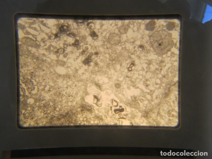 Fotografía antigua: 47 diapositivas microfotografías de tejidos biológicos, medicina - Foto 15 - 228456046