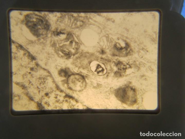 Fotografía antigua: 47 diapositivas microfotografías de tejidos biológicos, medicina - Foto 17 - 228456046