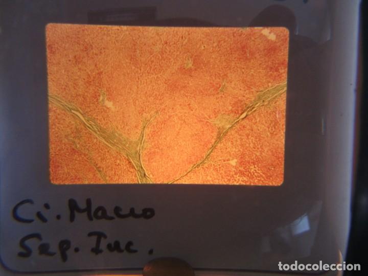 Fotografía antigua: 47 diapositivas microfotografías de tejidos biológicos, medicina - Foto 19 - 228456046