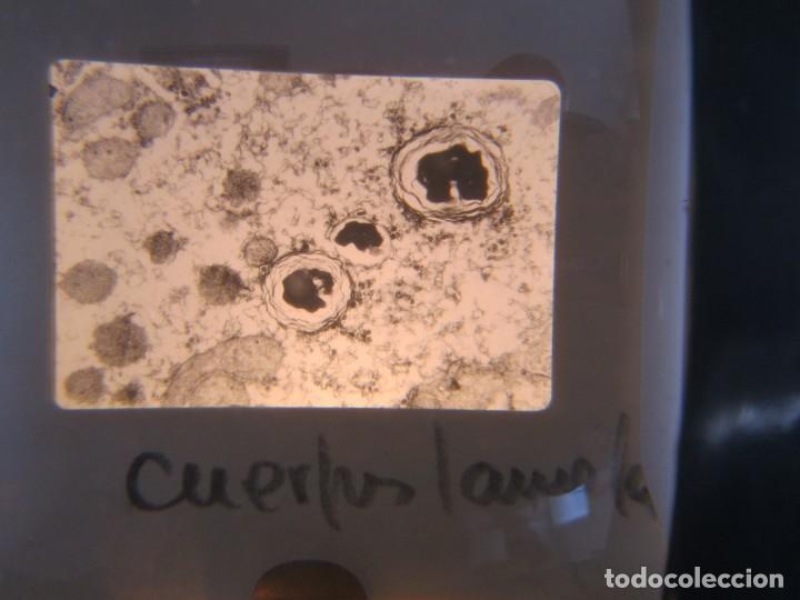 Fotografía antigua: 47 diapositivas microfotografías de tejidos biológicos, medicina - Foto 20 - 228456046