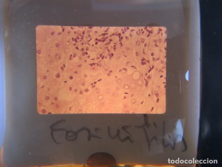 Fotografía antigua: 47 diapositivas microfotografías de tejidos biológicos, medicina - Foto 21 - 228456046