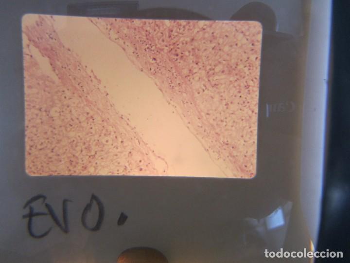 Fotografía antigua: 47 diapositivas microfotografías de tejidos biológicos, medicina - Foto 23 - 228456046